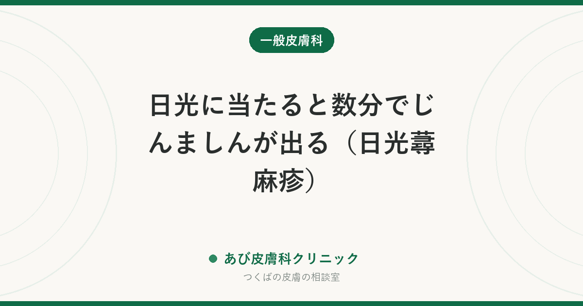 日光に当たると数分でじんましんが出る（日光蕁麻疹）｜光線過敏症との違い、窓越しでも出る理由と治療・検査