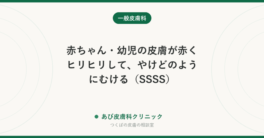 赤ちゃん・幼児の皮膚が赤くヒリヒリして、やけどのようにむける（SSSS）｜とびひとの違いと、すぐ受診すべきサイン