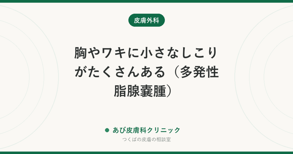 胸やワキに小さなしこりがたくさんある（多発性脂腺嚢腫）｜粉瘤との違い、取るべきかの判断と治療法