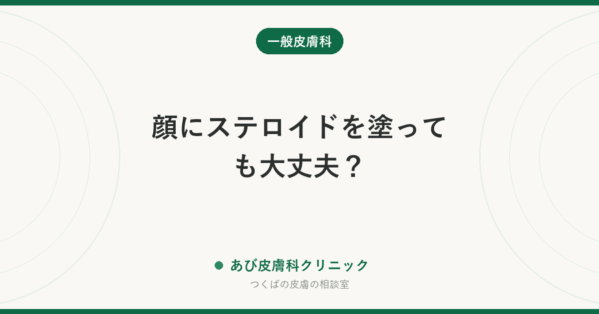 顔にステロイドを塗っても大丈夫？｜顔用の強さ・期間の目安と、顔に塗ってはいけないケース