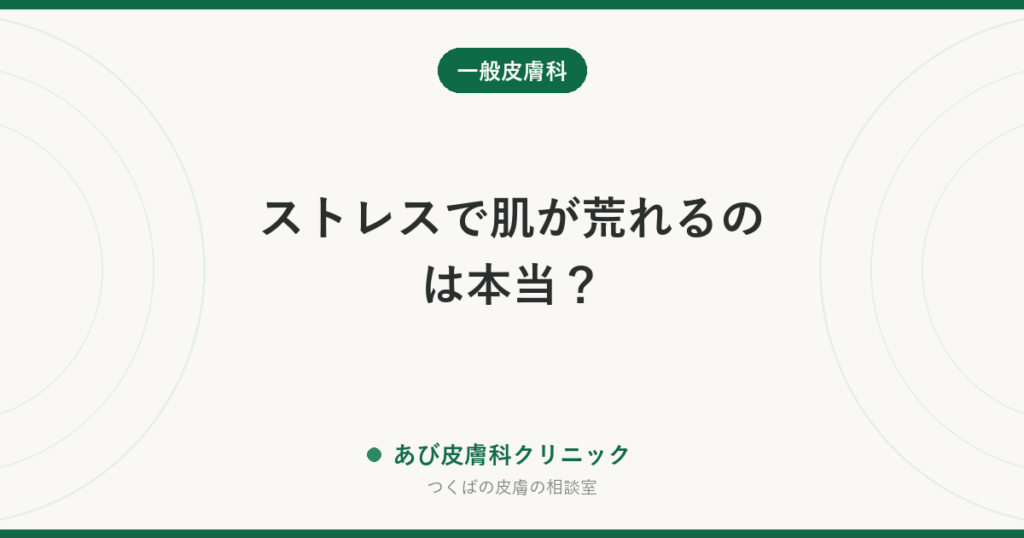 ストレスで肌が荒れるのは本当？｜湿疹・じんましん・脱毛が悪化する仕組みと対処