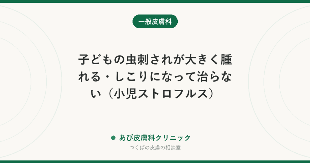 子どもの虫刺されが大きく腫れる・しこりになって治らない（小児ストロフルス）｜大人と反応が違う理由とかきこわし対策