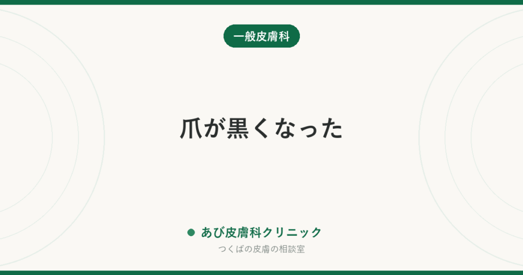 爪が黒くなった｜ぶつけた内出血（爪下血腫）とほくろ・メラノーマの見分け方と、痛いときの対処