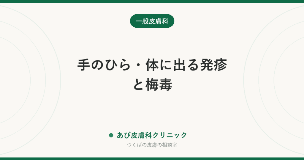 手のひら・体に出る発疹と梅毒｜かゆくない発疹が消えても治っていない理由と、検査の受け方