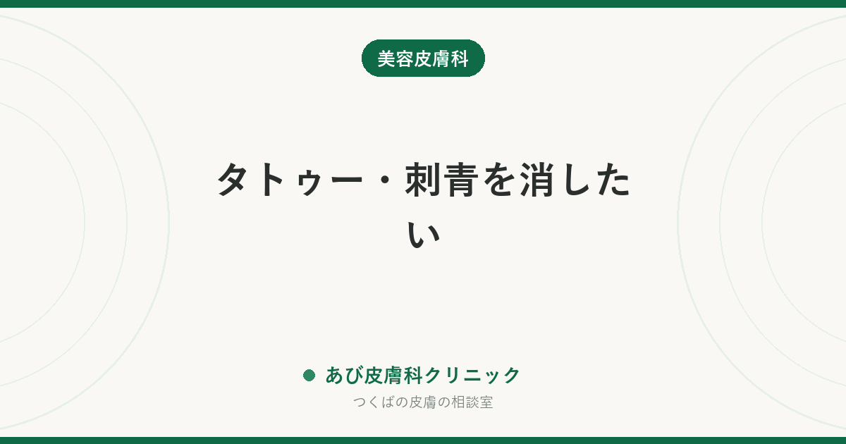 タトゥー・刺青を消したい｜レーザーと切除の違い、何回かかるか、消えない色と残る跡のこと