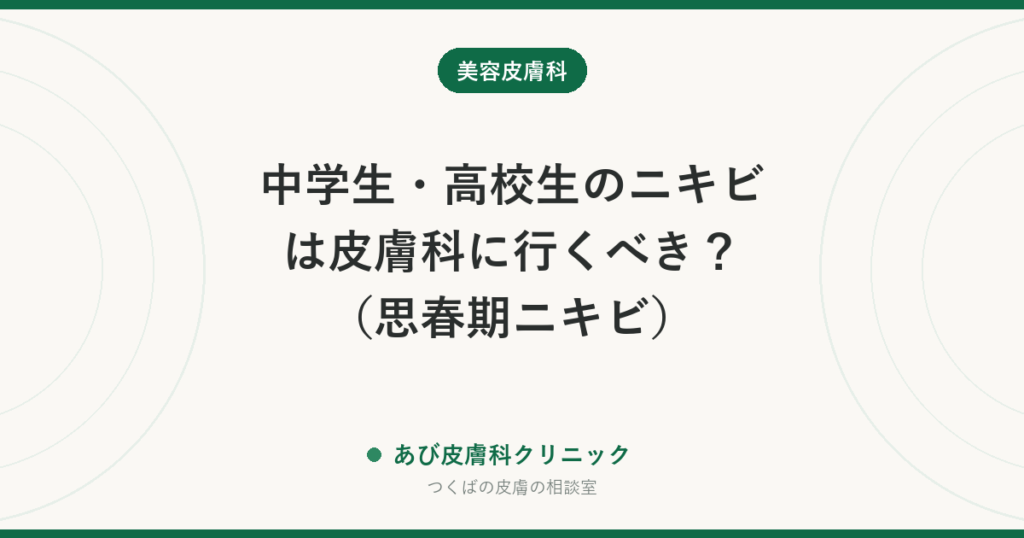 中学生・高校生のニキビは皮膚科に行くべき？（思春期ニキビ）｜保険で使える治療と、跡を残さないための受診の目安