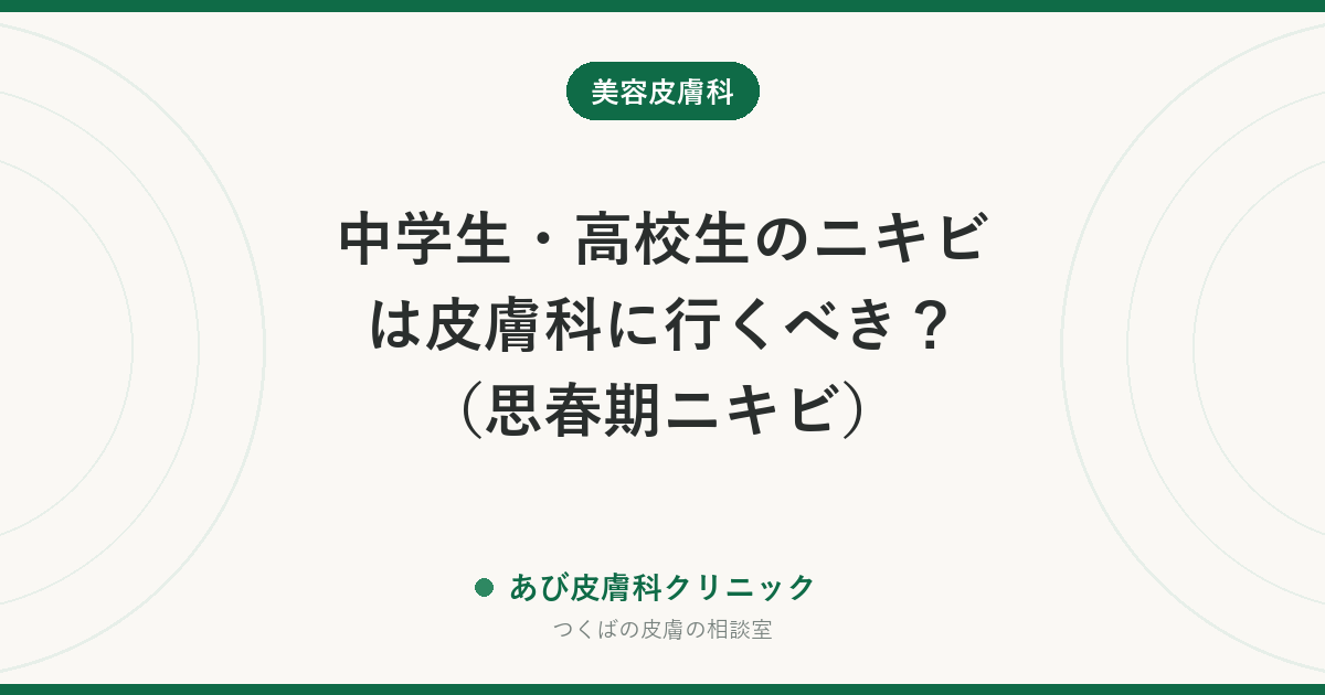 中学生・高校生のニキビは皮膚科に行くべき？（思春期ニキビ）｜保険で使える治療と、跡を残さないための受診の目安