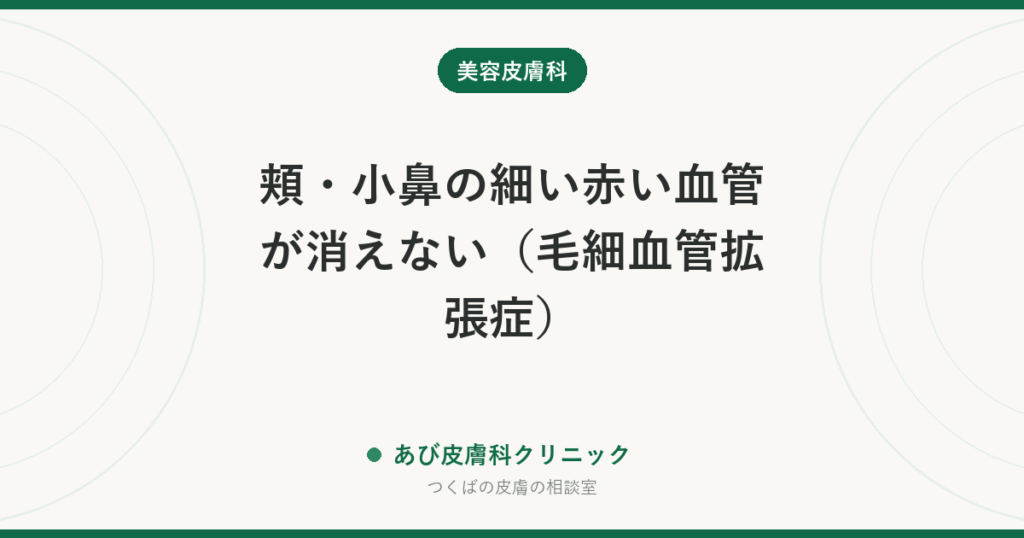 頬・小鼻の細い赤い血管が消えない（毛細血管拡張症）｜原因と治療、赤ら顔との関係