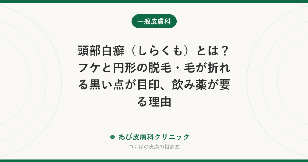頭部白癬（しらくも）とは？フケと円形の脱毛・毛が折れる黒い点が目印、飲み薬が要る理由