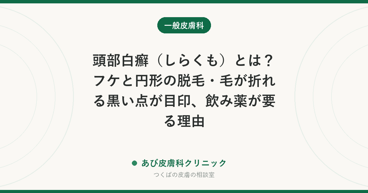 頭部白癬（しらくも）とは？フケと円形の脱毛・毛が折れる黒い点が目印、飲み薬が要る理由