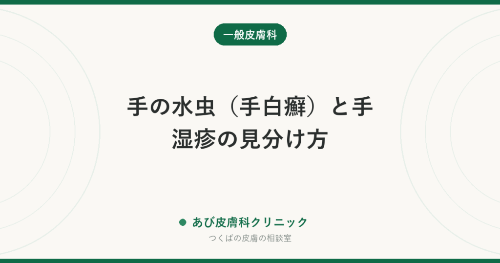 手の水虫（手白癬）と手湿疹の見分け方｜片手だけ・ステロイドで悪化するのがサイン