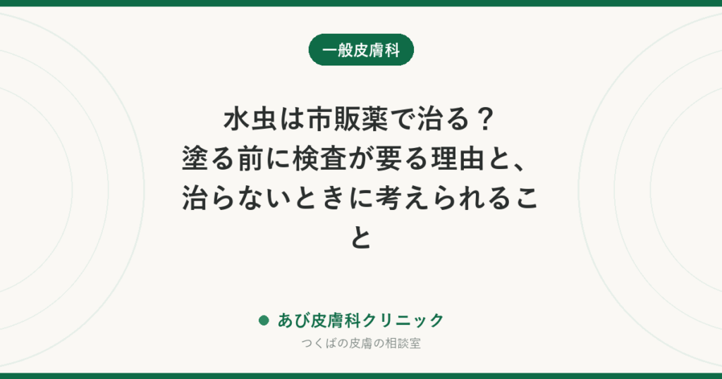水虫は市販薬で治る？塗る前に検査が要る理由と、治らないときに考えられること