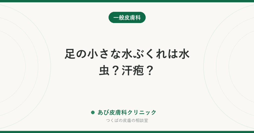 足の小さな水ぶくれは水虫？汗疱？｜見分け方と、市販薬を塗る前にやるべきこと