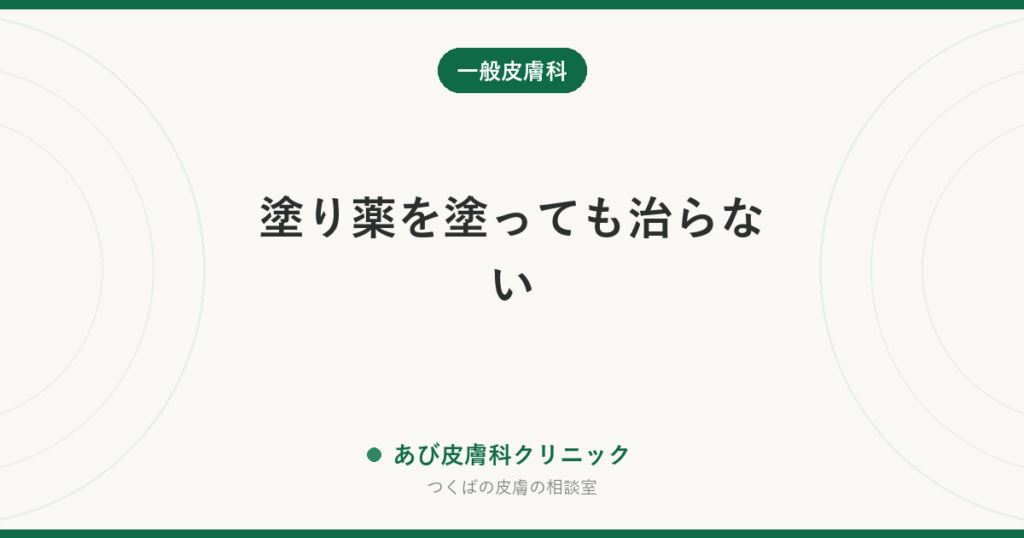 塗り薬を塗っても治らない｜皮膚科医が最初に疑う5つの理由と、いつ相談し直すべきか