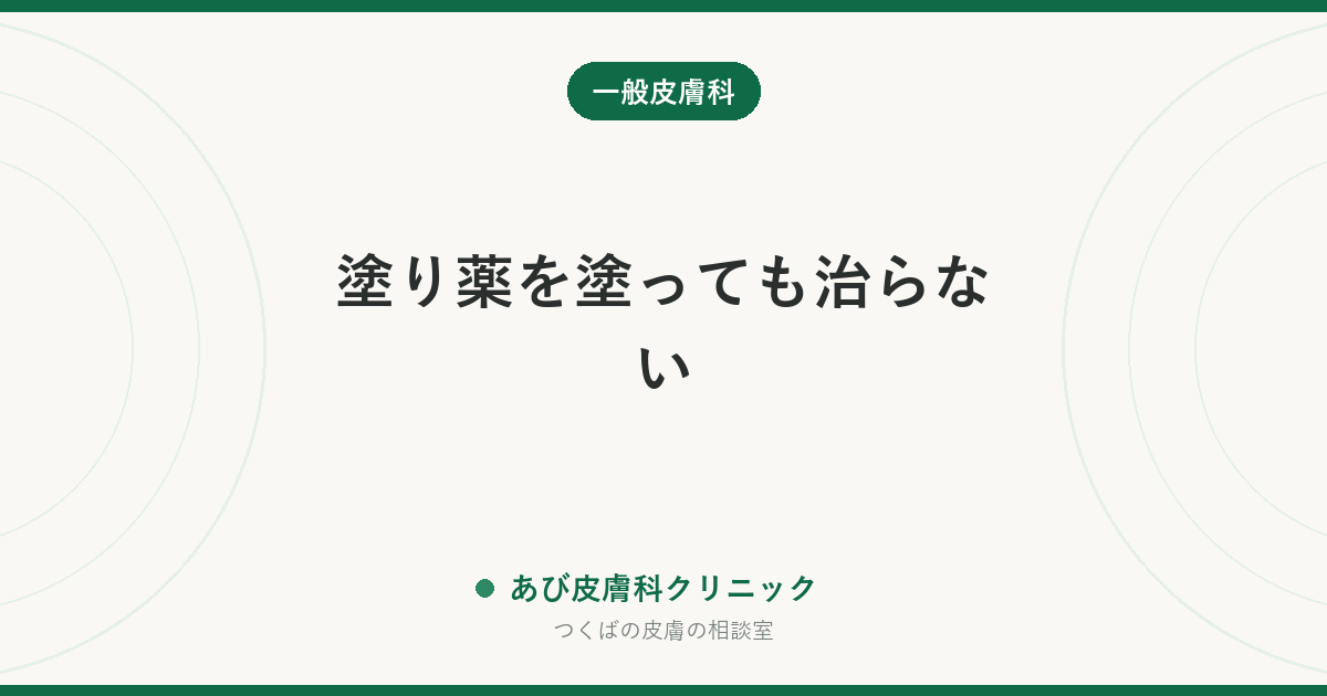 塗り薬を塗っても治らない｜皮膚科医が最初に疑う5つの理由と、いつ相談し直すべきか