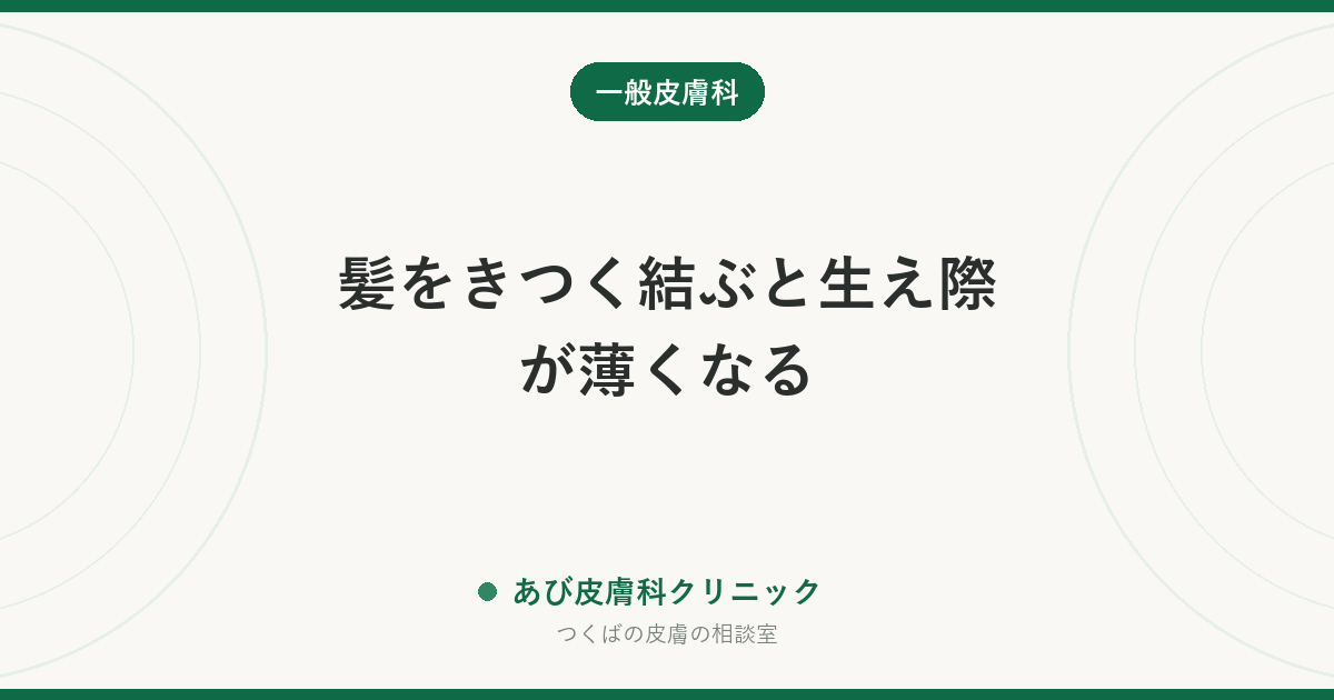 髪をきつく結ぶと生え際が薄くなる｜牽引性脱毛症は早ければ戻る。戻らなくなる前のサイン
