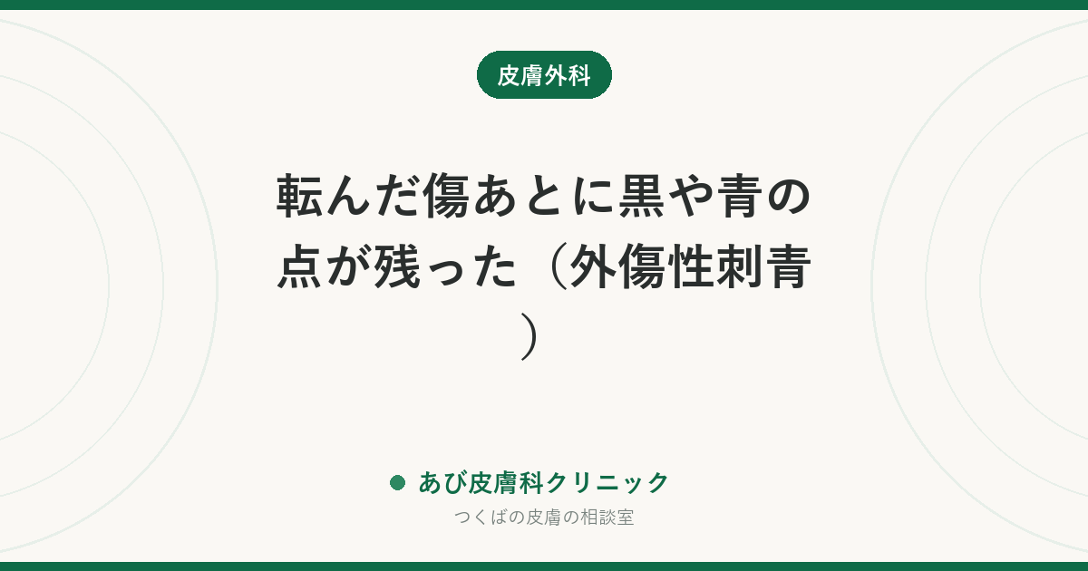 転んだ傷あとに黒や青の点が残った(外傷性刺青)|砂や鉛筆の芯が皮膚に残る理由と、けがの直後に取り除くべきわけ