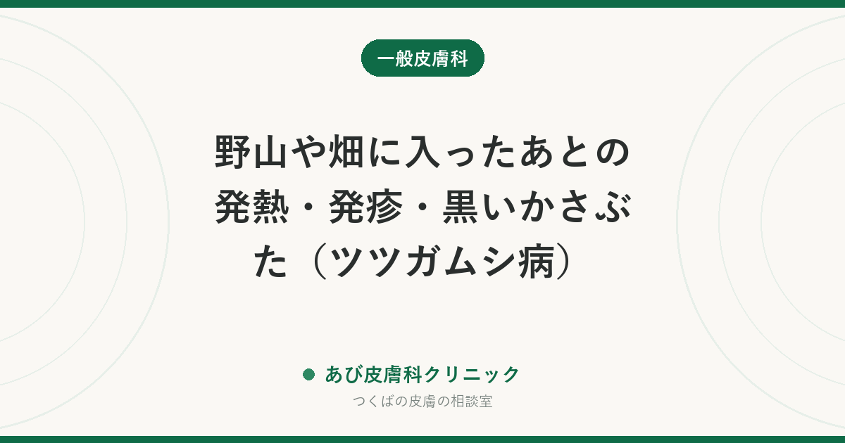 野山や畑に入ったあとの発熱・発疹・黒いかさぶた（ツツガムシ病）｜刺し口の探し方と、早く受診してほしい理由