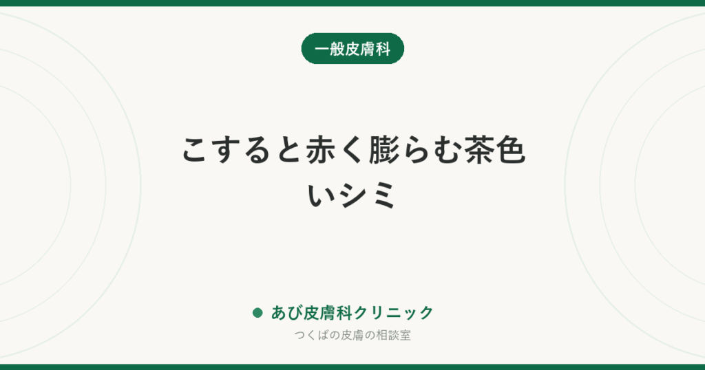 こすると赤く膨らむ茶色いシミ｜色素性蕁麻疹（皮膚肥満細胞症）とは？子どもと大人の違い、日常の注意点