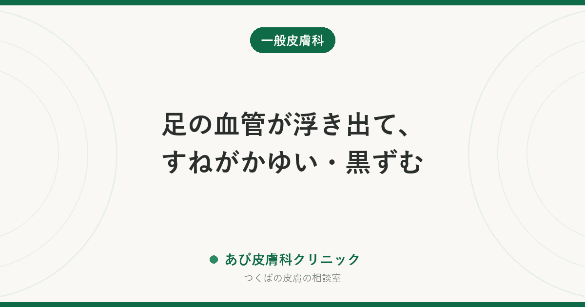 足の血管が浮き出て、すねがかゆい・黒ずむ｜下肢静脈瘤が皮膚に起こす変化と受診の目安