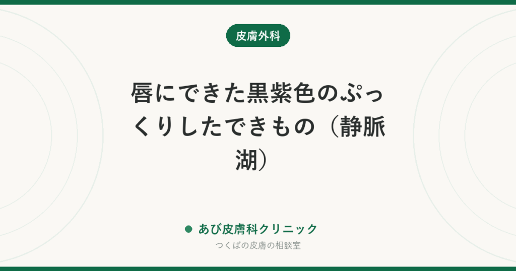 唇にできた黒紫色のぷっくりしたできもの（静脈湖）｜押すと色が薄くなれば良性の血管のふくらみ。気になれば取れます