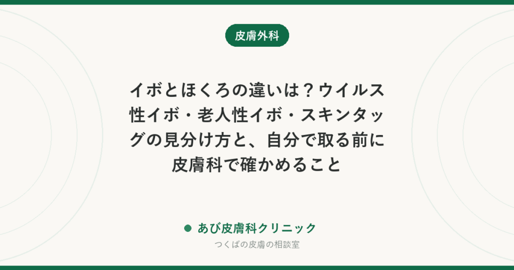 イボとほくろの違いは？ウイルス性イボ・老人性イボ・スキンタッグの見分け方と、自分で取る前に皮膚科で確かめること