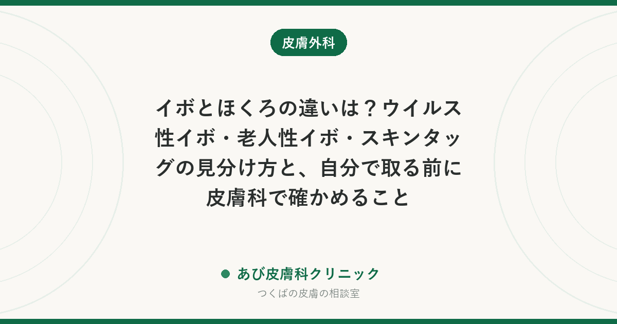 イボとほくろの違いは？ウイルス性イボ・老人性イボ・スキンタッグの見分け方と、自分で取る前に皮膚科で確かめること