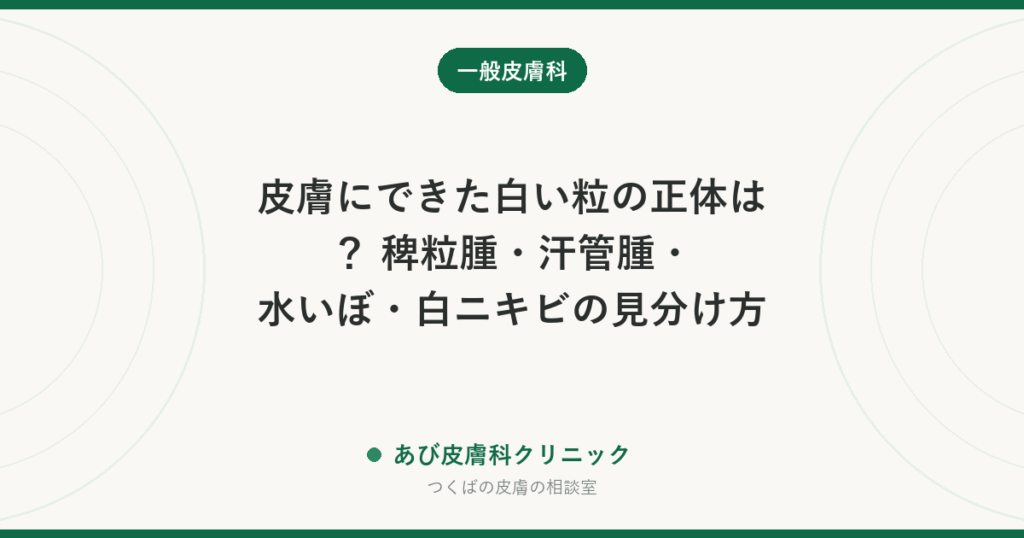 皮膚にできた白い粒の正体は？ 稗粒腫・汗管腫・水いぼ・白ニキビの見分け方