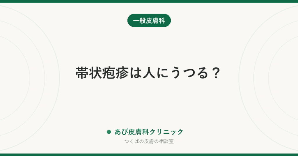 帯状疱疹は人にうつる？｜うつるのは「水ぼうそう」として。赤ちゃん・妊婦さんへの注意点