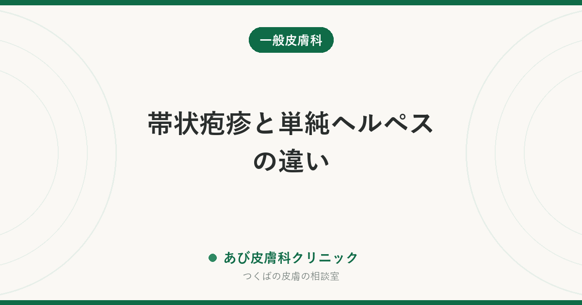 帯状疱疹と単純ヘルペスの違い｜同じ「ヘルペス」でも急ぎ方がまったく違います
