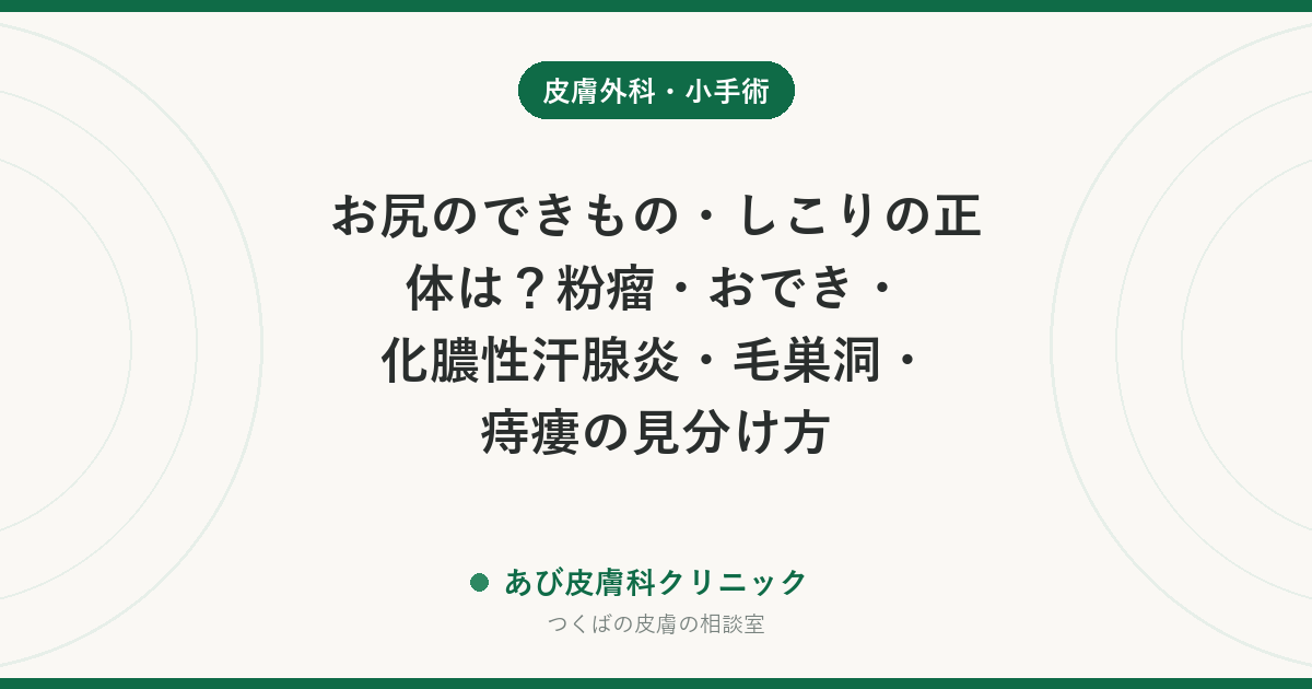 お尻のできもの・しこりの正体は？粉瘤・おでき・化膿性汗腺炎・毛巣洞・痔瘻の見分け方