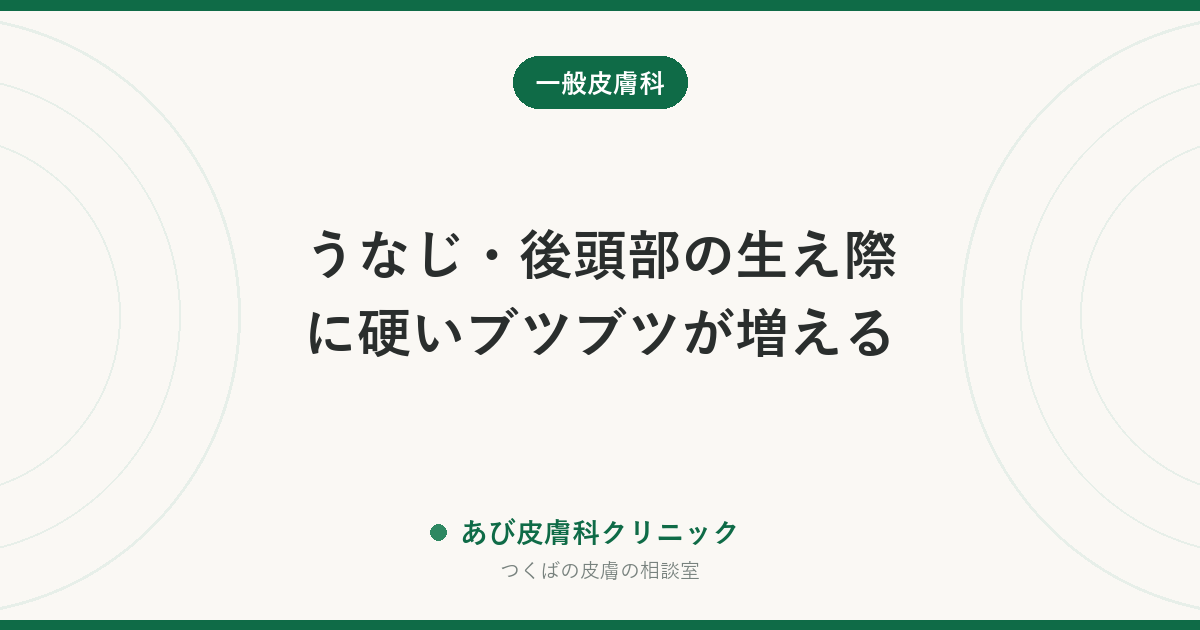 うなじ・後頭部の生え際に硬いブツブツが増える｜項部ケロイド性ざ瘡とは？原因と早めの治療