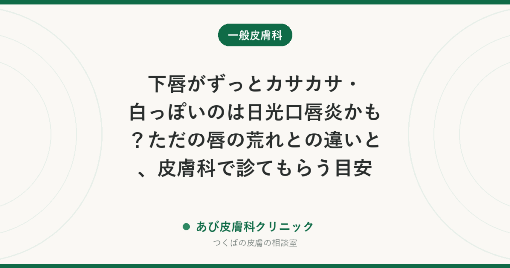 下唇がずっとカサカサ・白っぽいのは日光口唇炎かも？ただの唇の荒れとの違いと、皮膚科で診てもらう目安