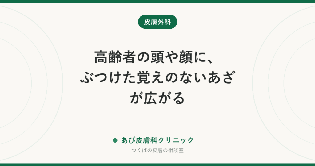 高齢者の頭や顔に、ぶつけた覚えのないあざが広がる｜血管肉腫とは？内出血との見分け方と早めの受診が大切な理由