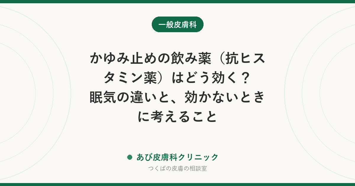かゆみ止めの飲み薬（抗ヒスタミン薬）はどう効く？眠気の違いと、効かないときに考えること