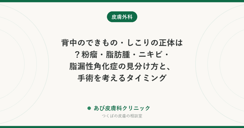 背中のできもの・しこりの正体は？粉瘤・脂肪腫・ニキビ・脂漏性角化症の見分け方と、手術を考えるタイミング
