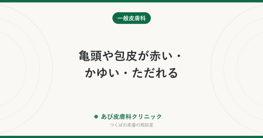 亀頭や包皮が赤い・かゆい・ただれる｜亀頭包皮炎の原因と治し方、性感染症との見分け