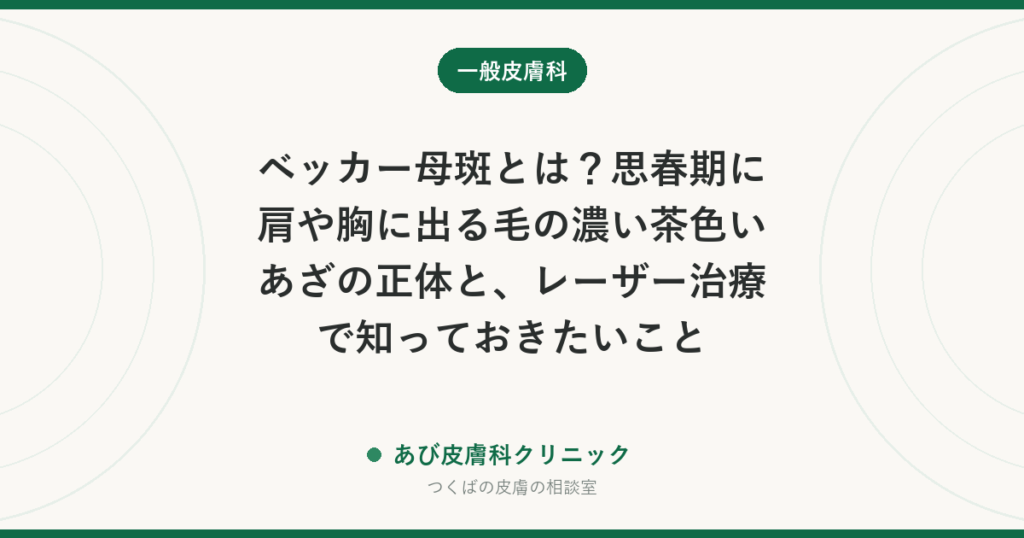 ベッカー母斑とは？思春期に肩や胸に出る毛の濃い茶色いあざの正体と、レーザー治療で知っておきたいこと
