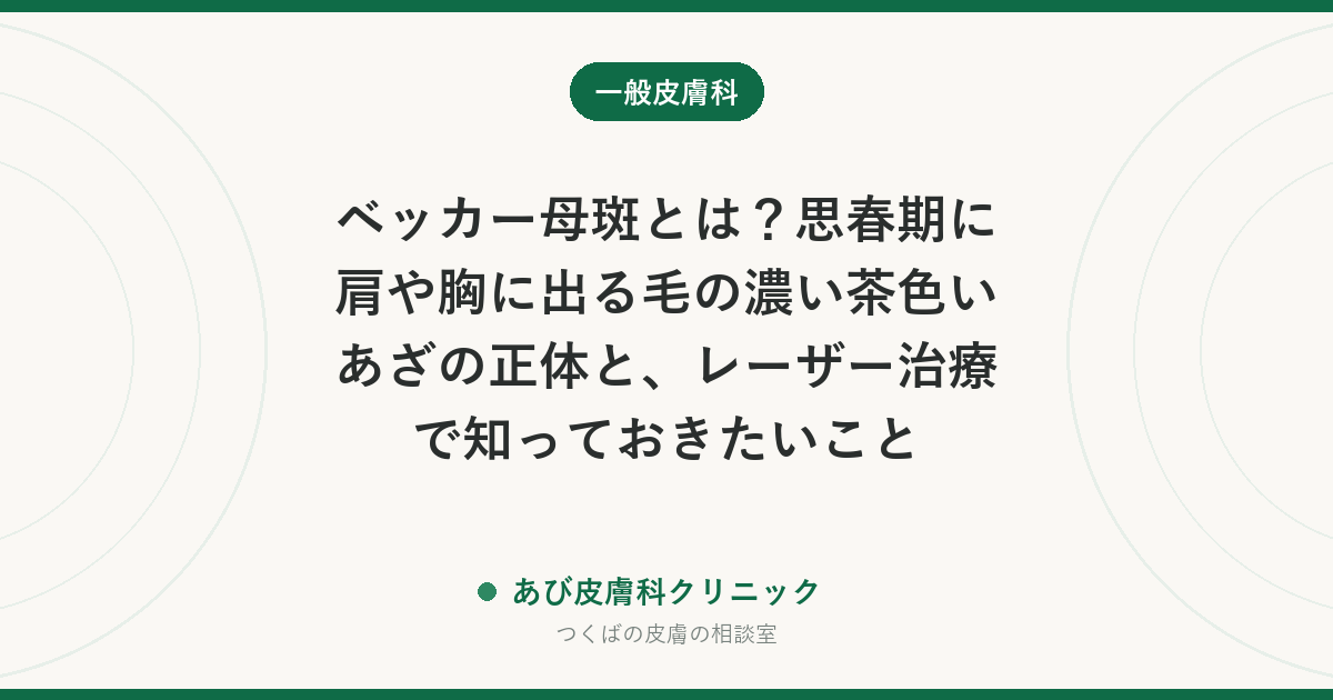 ベッカー母斑とは?思春期に肩や胸に出る毛の濃い茶色いあざの正体と、レーザー治療で知っておきたいこと