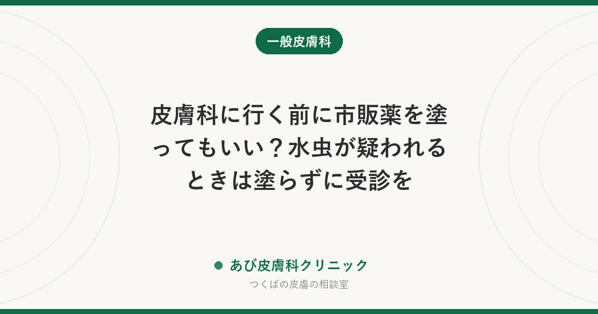皮膚科に行く前に市販薬を塗ってもいい？水虫が疑われるときは塗らずに受診を｜診断に影響する薬と、持っていくもの