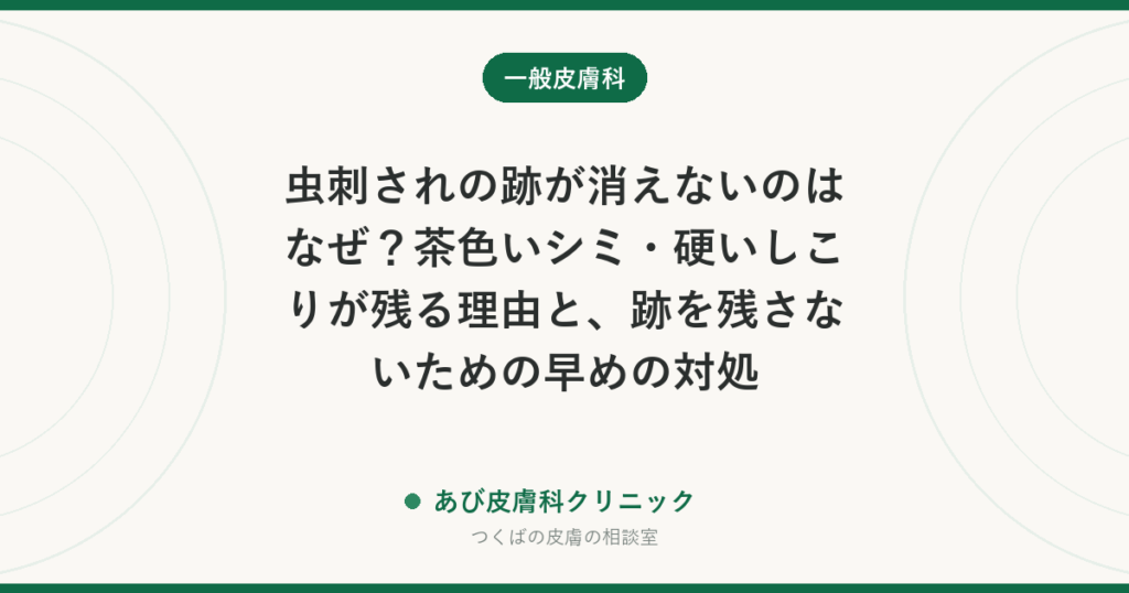 虫刺されの跡が消えないのはなぜ？茶色いシミ・硬いしこりが残る理由と、跡を残さないための早めの対処