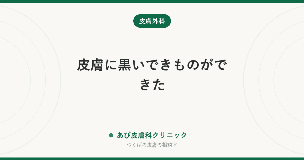 皮膚に黒いできものができた｜ほくろ以外に考えられるものと、皮膚がんを見逃さないための受診の目安