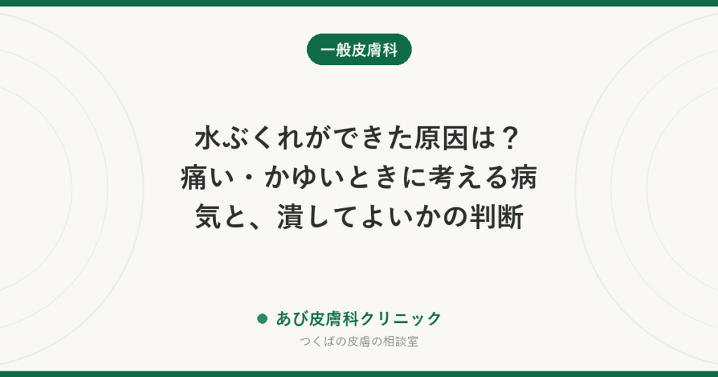 水ぶくれができた原因は？痛い・かゆいときに考える病気と、潰してよいかの判断