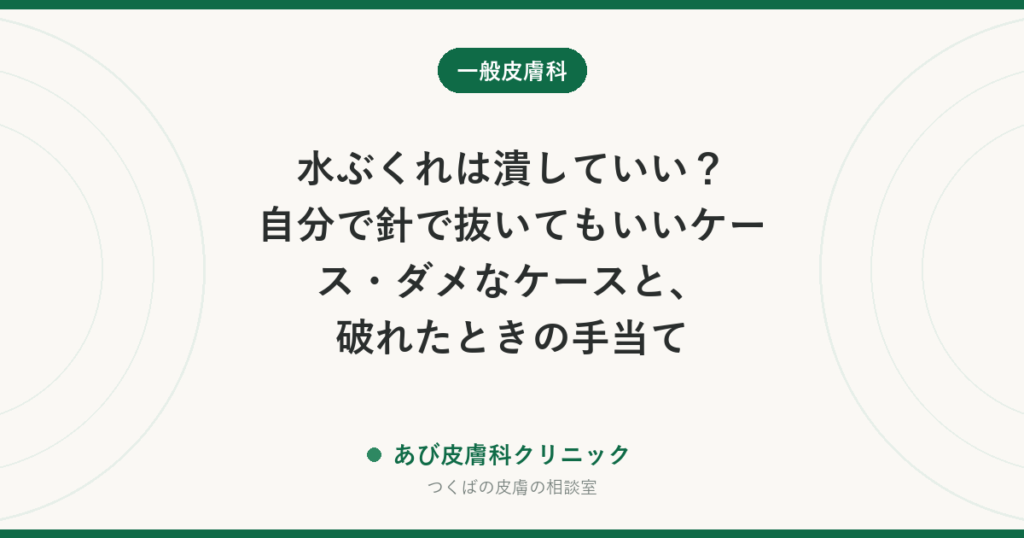 水ぶくれは潰していい？自分で針で抜いてもいいケース・ダメなケースと、破れたときの手当て
