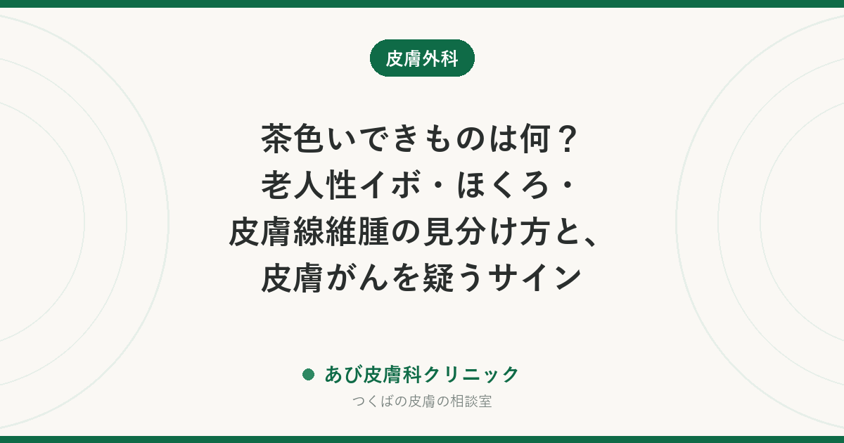 茶色いできものは何？老人性イボ・ほくろ・皮膚線維腫の見分け方と、皮膚がんを疑うサイン