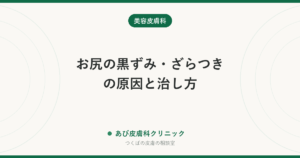 お尻の黒ずみ・ざらつきの原因と治し方｜座りっぱなし・摩擦・毛穴の炎症のあとを薄くするために今日からできること