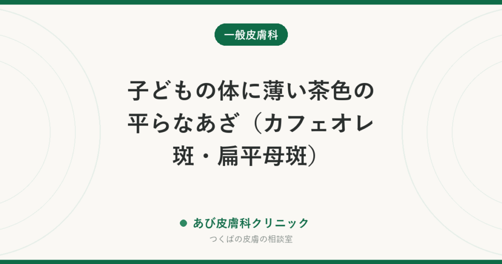 子どもの体に薄い茶色の平らなあざ（カフェオレ斑・扁平母斑）｜数が多いときに確かめること、レーザー治療の考え方