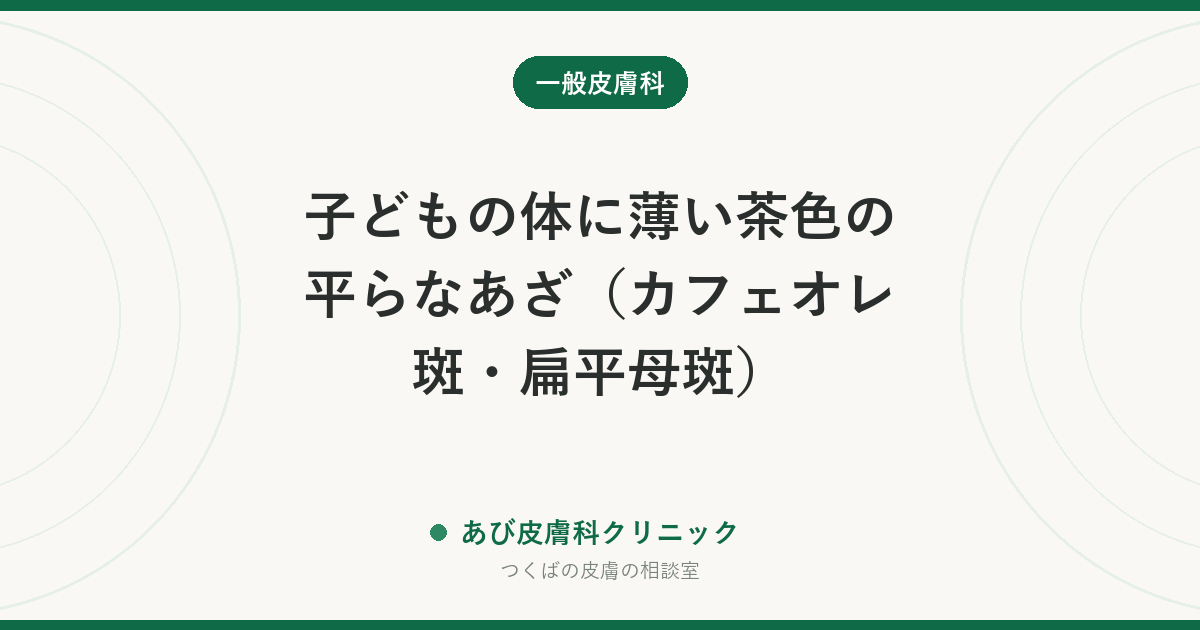 子どもの体に薄い茶色の平らなあざ（カフェオレ斑・扁平母斑）｜数が多いときに確かめること、レーザー治療の考え方