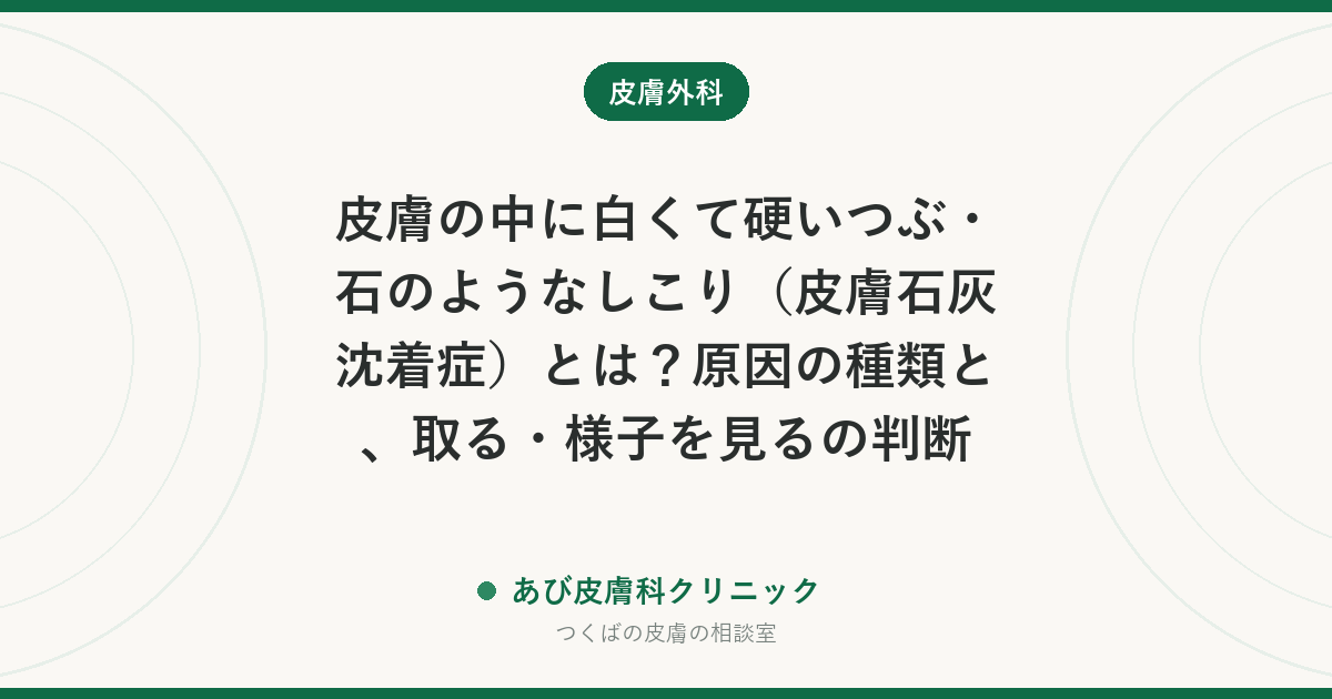 皮膚の中に白くて硬いつぶ・石のようなしこり（皮膚石灰沈着症）とは？原因の種類と、取る・様子を見るの判断