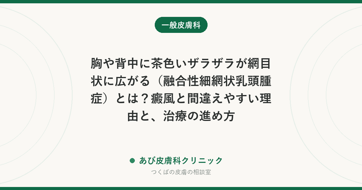 胸や背中に茶色いザラザラが網目状に広がる（融合性細網状乳頭腫症）とは？癜風と間違えやすい理由と、治療の進め方